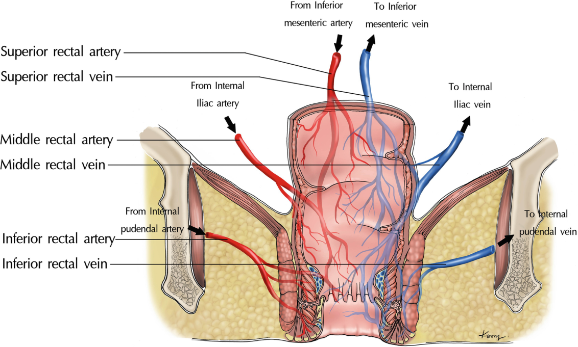  Open surgery Hernia